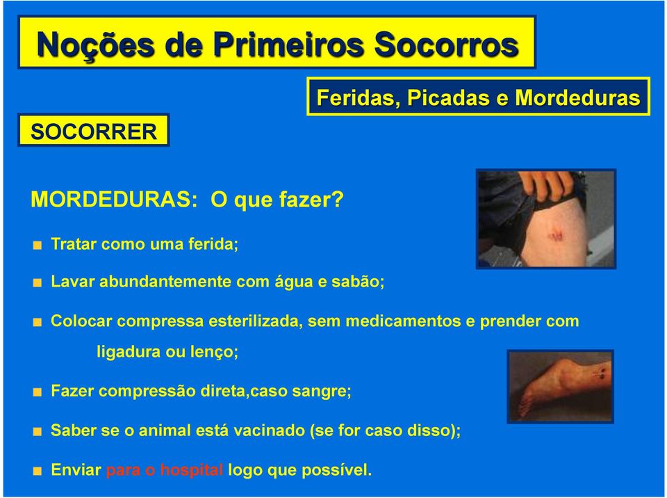 Colocar compressa esterilizada, sem medicamentos e prender com ligadura ou lenço;!