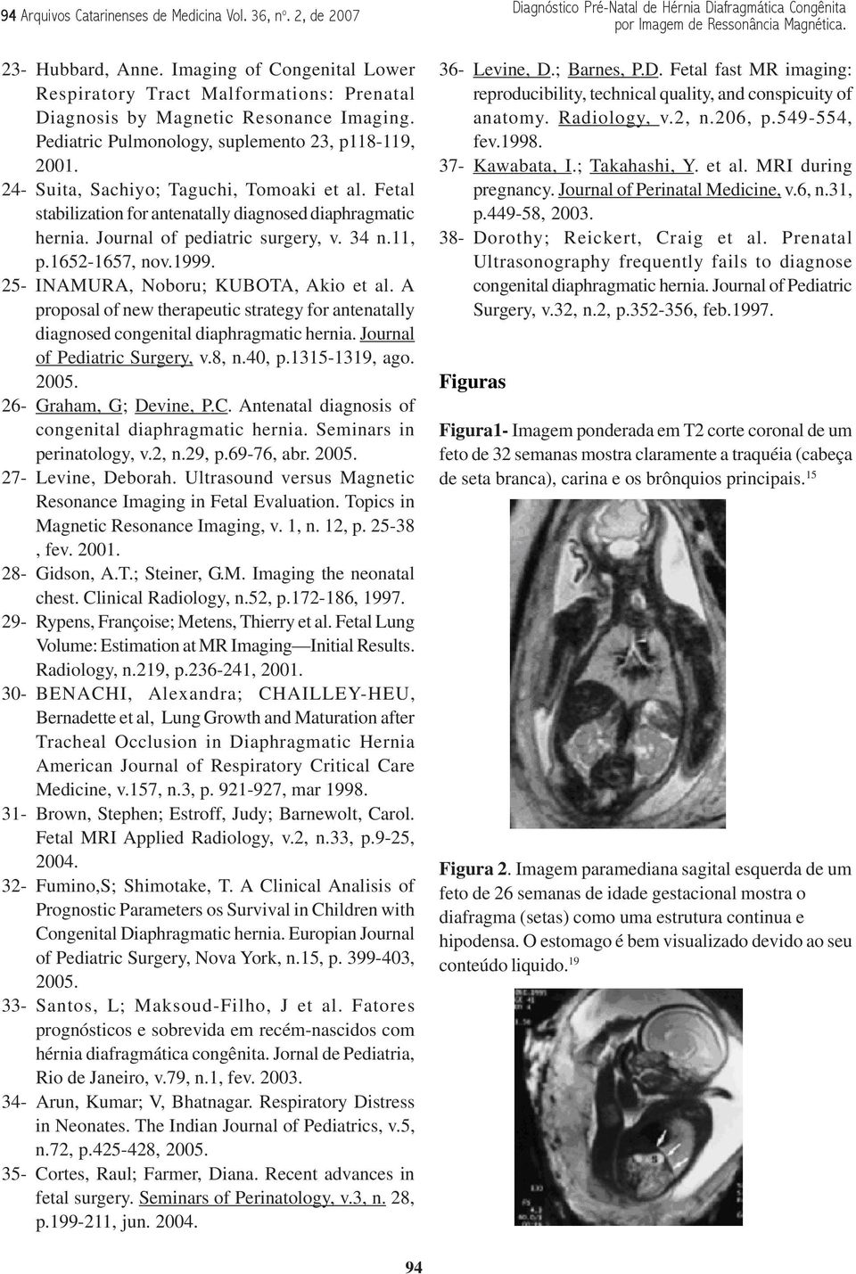 34 n.11, p.1652-1657, nov.1999. 25- INAMURA, Noboru; KUBOTA, Akio et al. A proposal of new therapeutic strategy for antenatally diagnosed congenital diaphragmatic hernia.