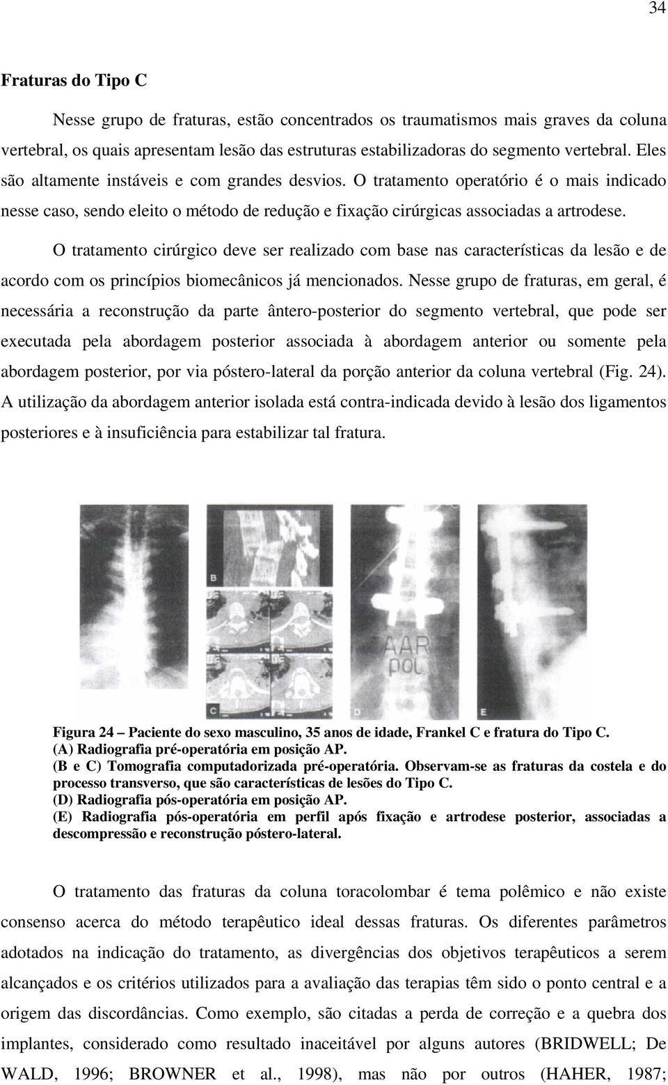 O tratamento cirúrgico deve ser realizado com base nas características da lesão e de acordo com os princípios biomecânicos já mencionados.