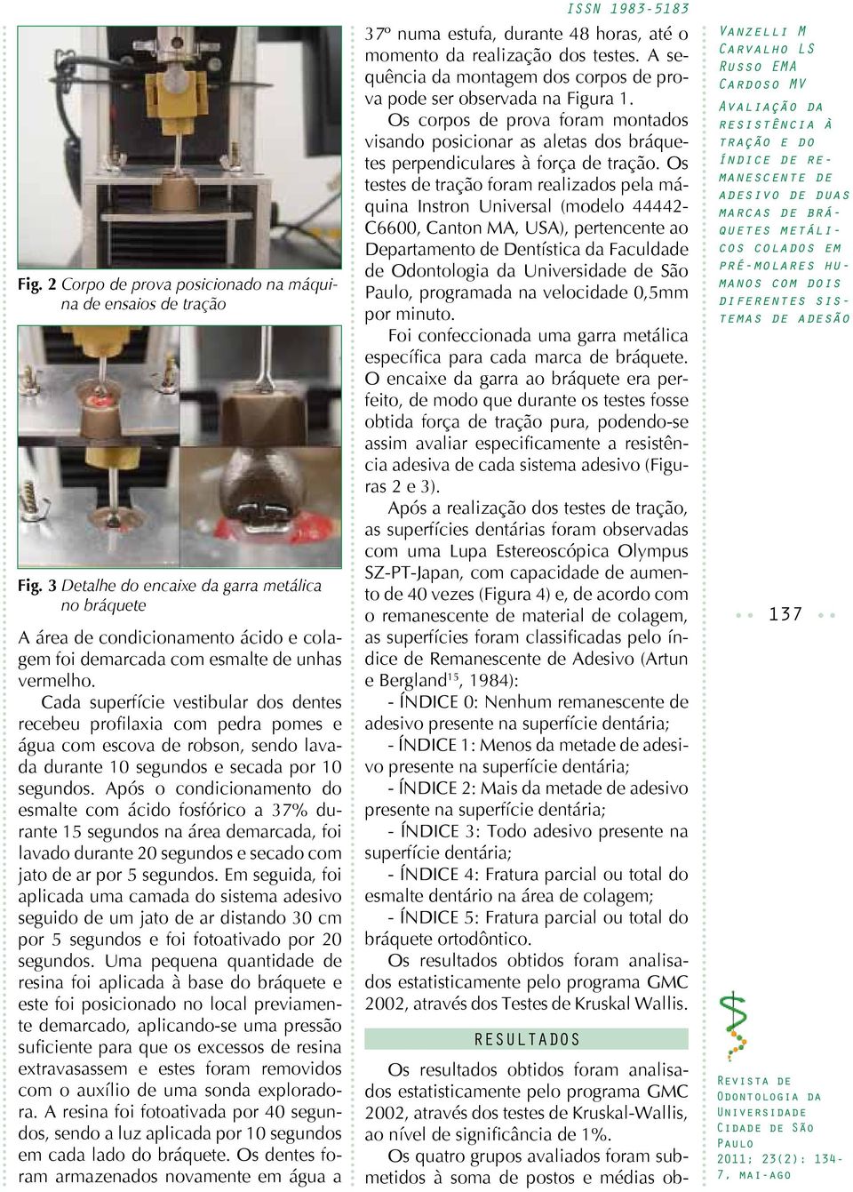 Após o condicionamento do esmalte com ácido fosfórico a 37% durante 15 segundos na área marcada, foi lavado durante 20 segundos e secado com jato ar por 5 segundos.