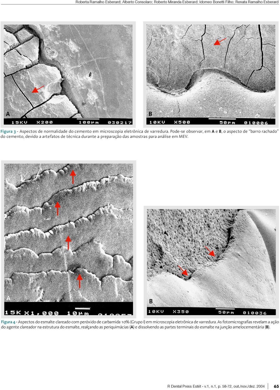 A B Figura 4 - Aspectos do esmalte clareado com peróxido de carbamida 10% (Grupo I) em microscopia eletrônica de varredura.