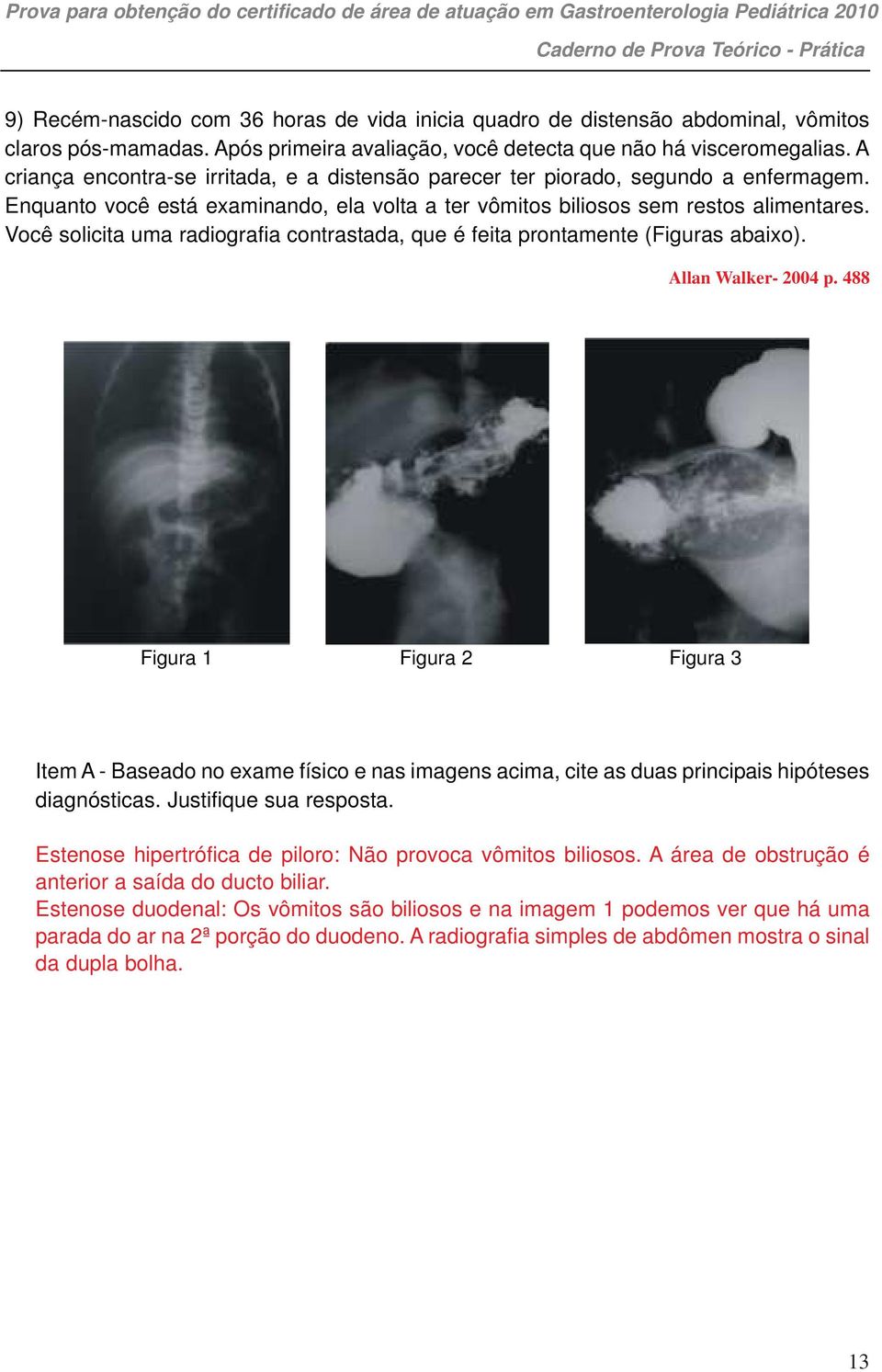 Você solicita uma radiografia contrastada, que é feita prontamente (Figuras abaixo). Allan Walker- 2004 p.