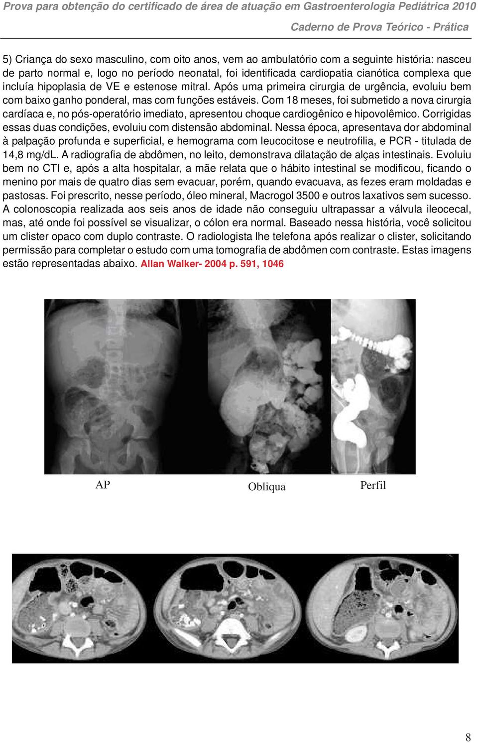 Com 18 meses, foi submetido a nova cirurgia cardíaca e, no pós-operatório imediato, apresentou choque cardiogênico e hipovolêmico. Corrigidas essas duas condições, evoluiu com distensão abdominal.