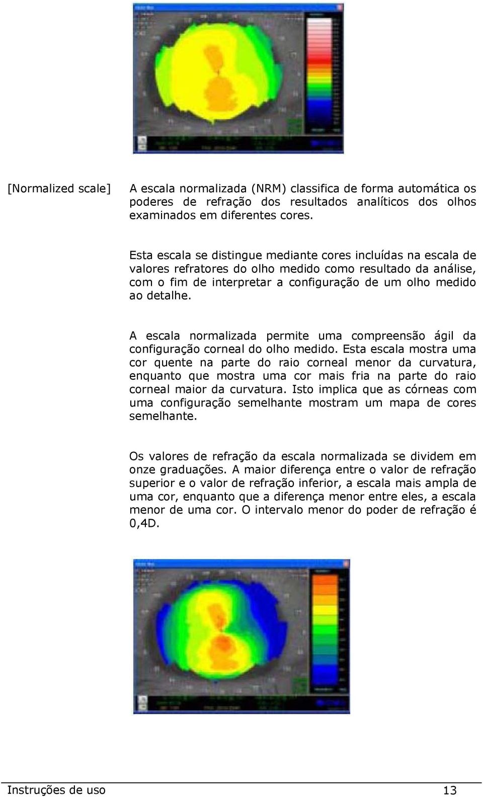 A escala normalizada permite uma compreensão ágil da configuração corneal do olho medido.