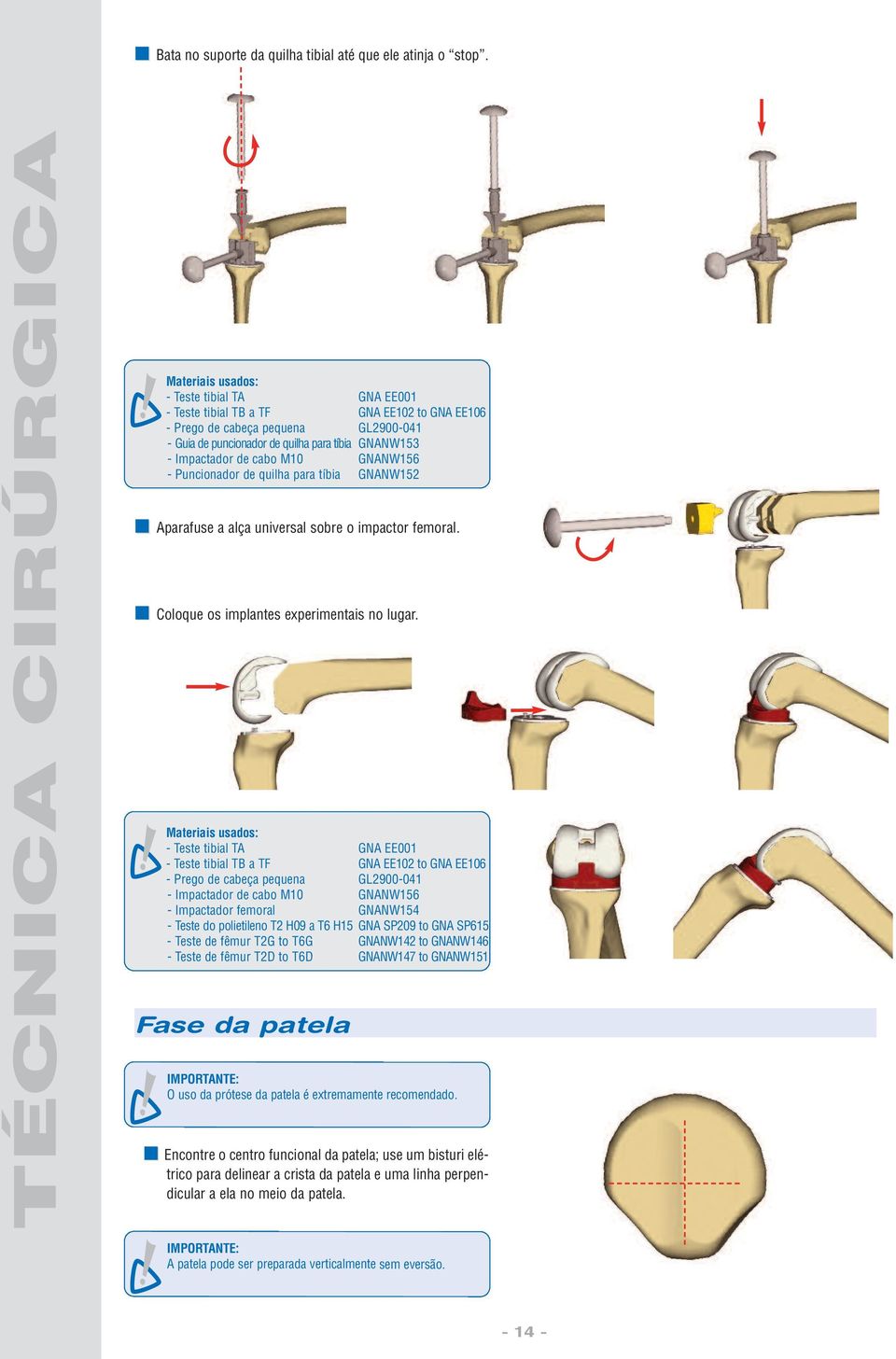 GNANW152 Aparafuse a alça universal sobre o impactor femoral. Coloque os implantes experimentais no lugar.