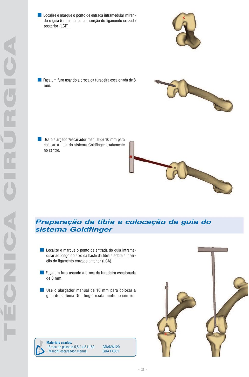 Preparação da tíbia e colocação da guia do sistema Goldfinger Localize e marque o ponto de entrada do guia intramedular ao longo do eixo da haste da tíbia e sobre a inserção do ligamento