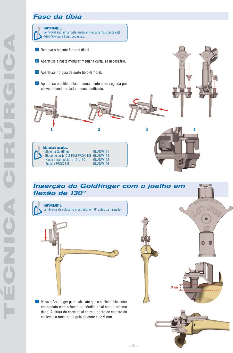 1 2 3 4 - Sistema Goldfinger GNANW121 - Bloco de corte DIS FEM PROX TIB GNANW124 - Haste intramedular ø 10 L150 GNANW122 - Estilete PROX TIB GNANW126 Inserção do Goldfinger com o joelho em flexão de