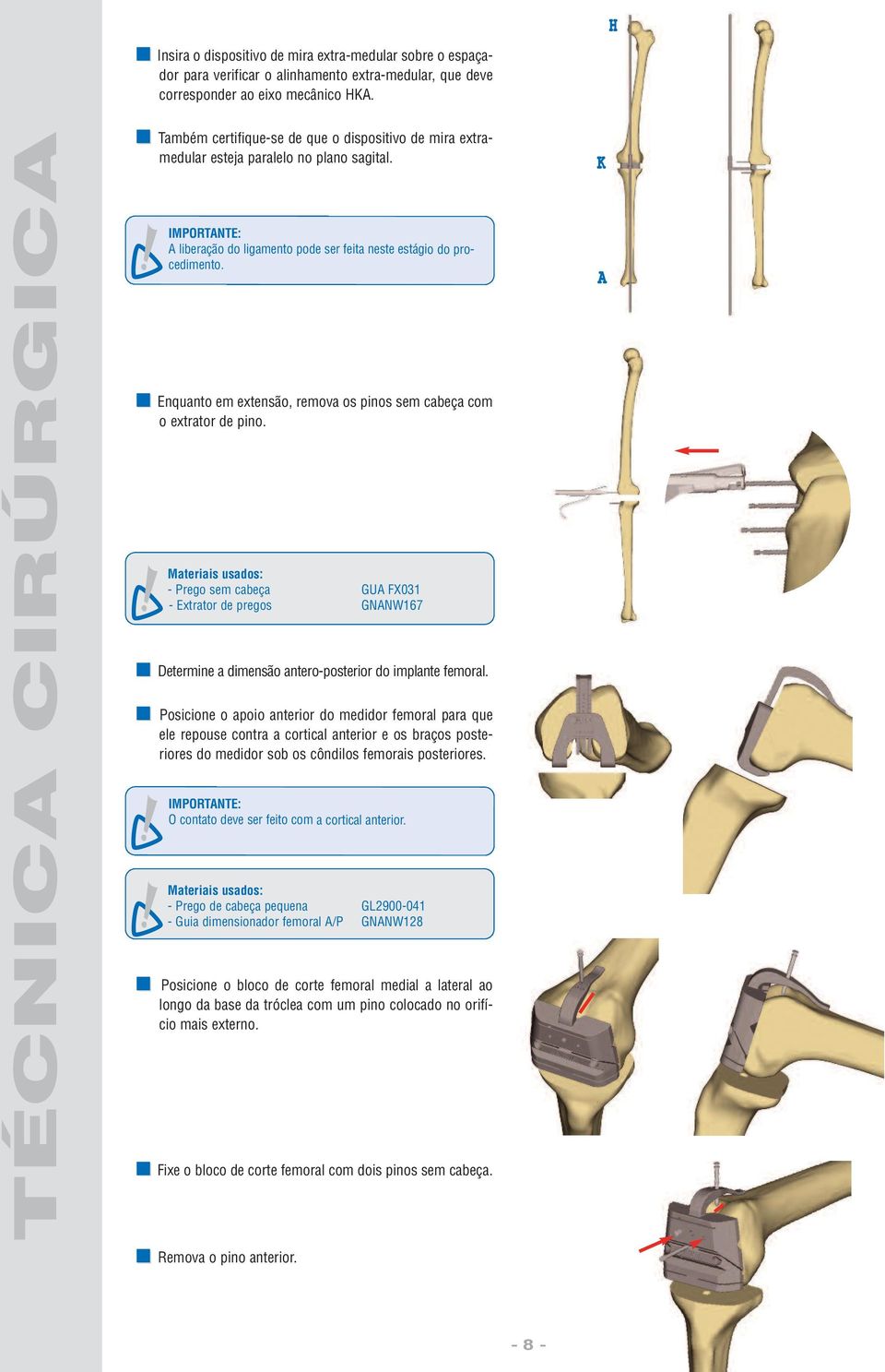 Enquanto em extensão, remova os pinos sem cabeça com o extrator de pino. - Prego sem cabeça GUA FX031 - Extrator de pregos GNANW167 Determine a dimensão antero-posterior do implante femoral.