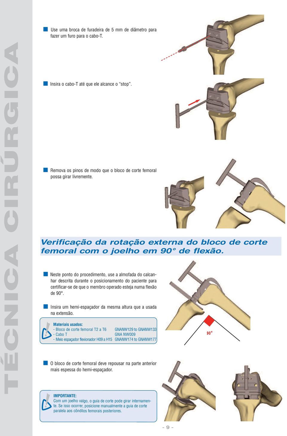 Neste ponto do procedimento, use a almofada do calcanhar descrita durante o posicionamento do paciente para certificar-se de que o membro operado esteja numa flexão de 90.