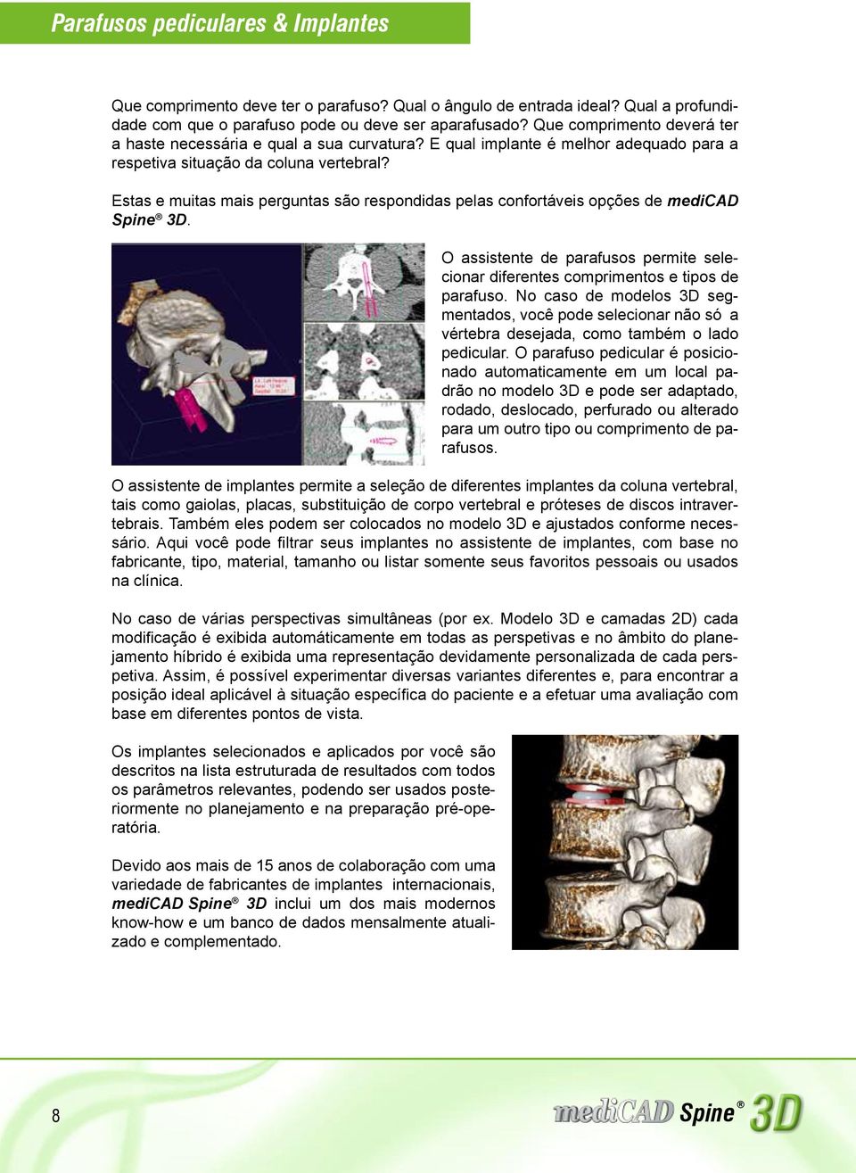 Estas e muitas mais perguntas são respondidas pelas confortáveis opções de medicad. O assistente de parafusos permite selecionar diferentes comprimentos e tipos de parafuso.