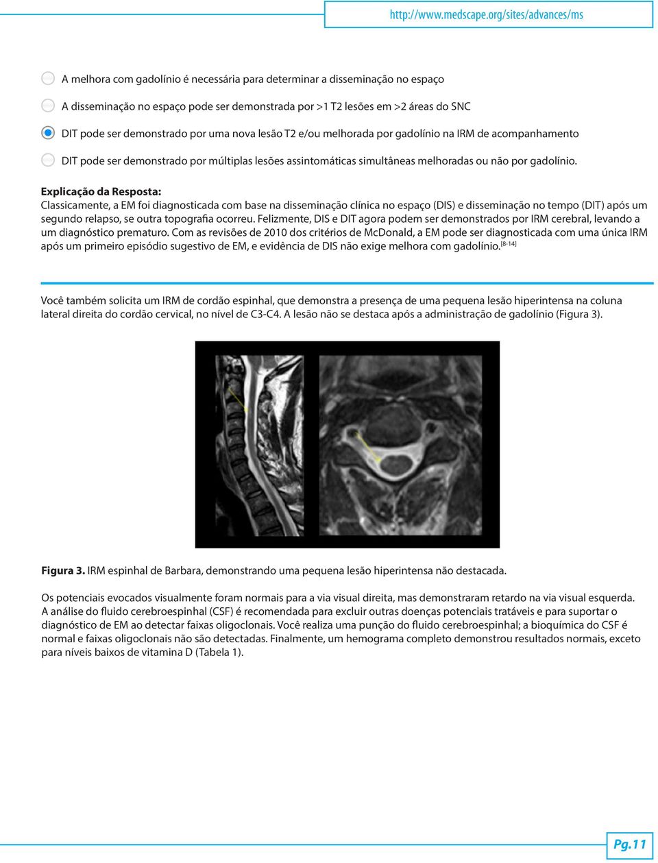 demonstrado por uma nova lesão T2 e/ou melhorada por gadolínio na IRM de acompanhamento DIT pode ser demonstrado por múltiplas lesões assintomáticas simultâneas melhoradas ou não por gadolínio.
