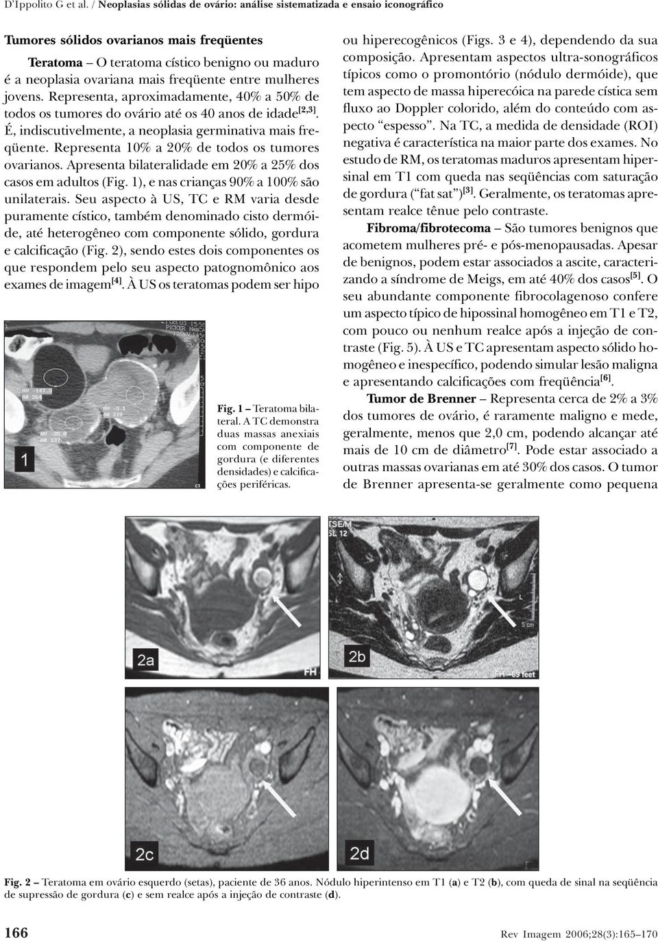 freqüente entre mulheres jovens. Representa, aproximadamente, 40% a 50% de todos os tumores do ovário até os 40 anos de idade [2,3]. É, indiscutivelmente, a neoplasia germinativa mais freqüente.