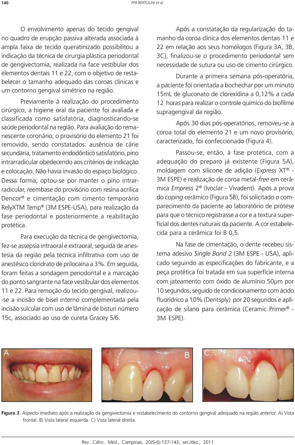gengivectomia, realizada na face vestibular dos elementos dentais 11 e 22, com o objetivo de restabelecer o tamanho adequado das coroas clínicas e um contorno gengival simétrico na região.