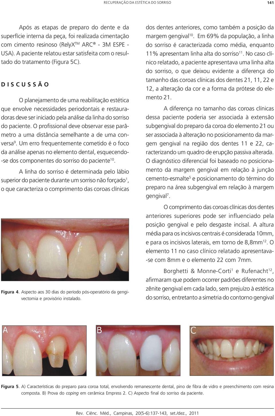 D I S C U S S Ã O O planejamento de uma reabilitação estética que envolve necessidades periodontais e restauradoras deve ser iniciado pela análise da linha do sorriso do paciente.