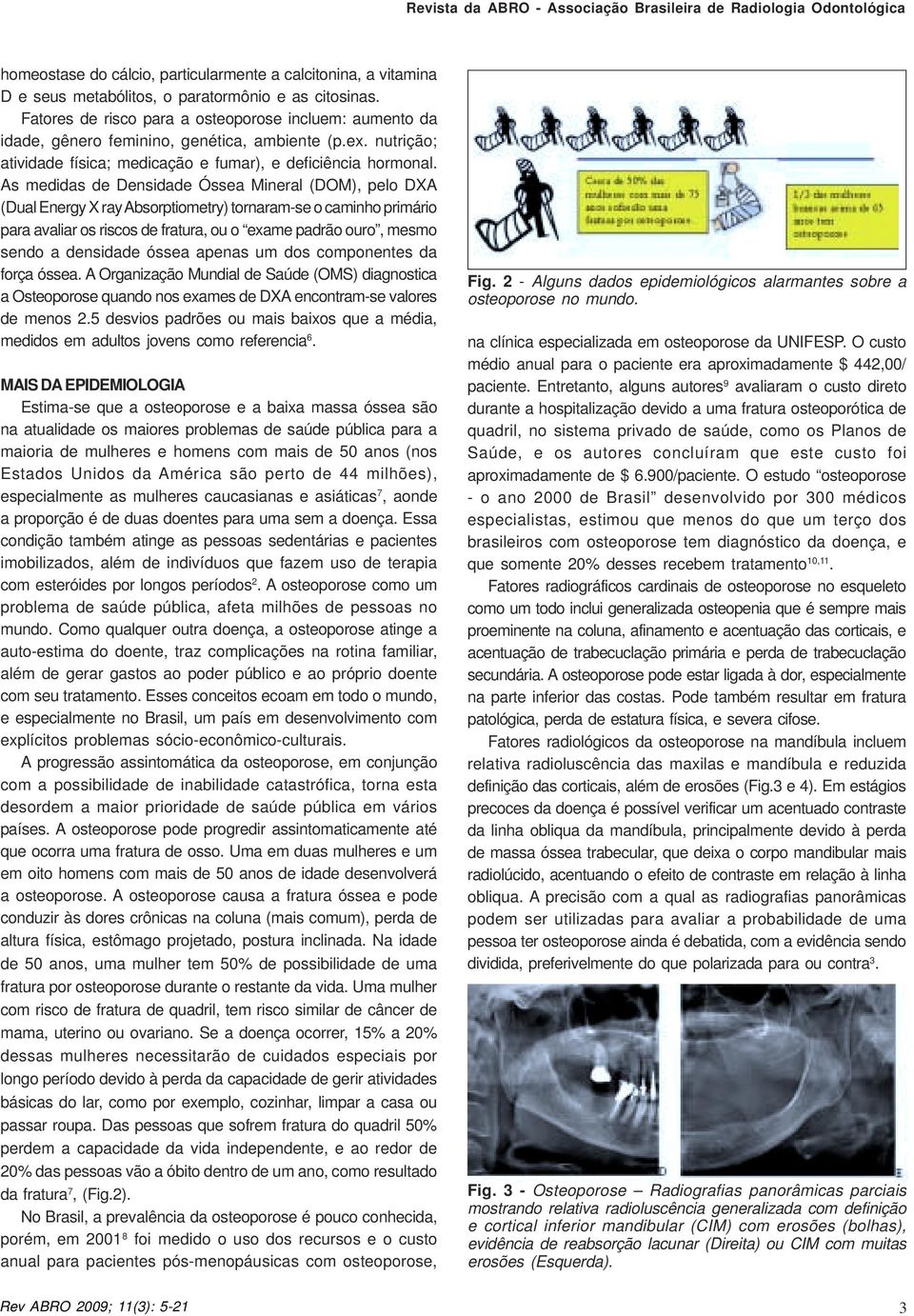 As medidas de Densidade Óssea Mineral (DOM), pelo DXA (Dual Energy X ray Absorptiometry) tornaram-se o caminho primário para avaliar os riscos de fratura, ou o exame padrão ouro, mesmo sendo a