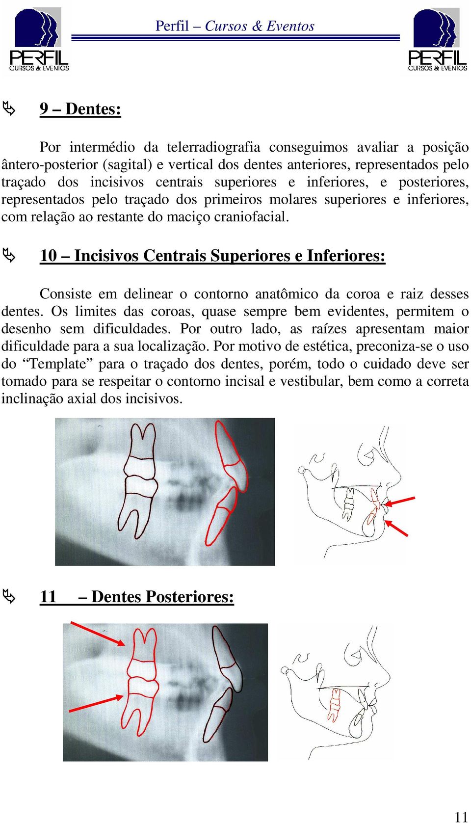 10 Incisivos Centrais Superiores e Inferiores: Consiste em delinear o contorno anatômico da coroa e raiz desses dentes.