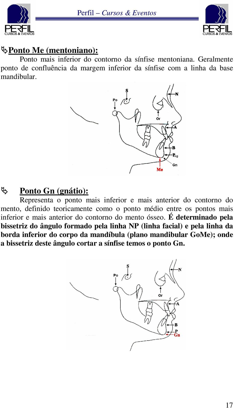Ponto Gn (gnátio): Representa o ponto mais inferior e mais anterior do contorno do mento, definido teoricamente como o ponto médio entre os pontos