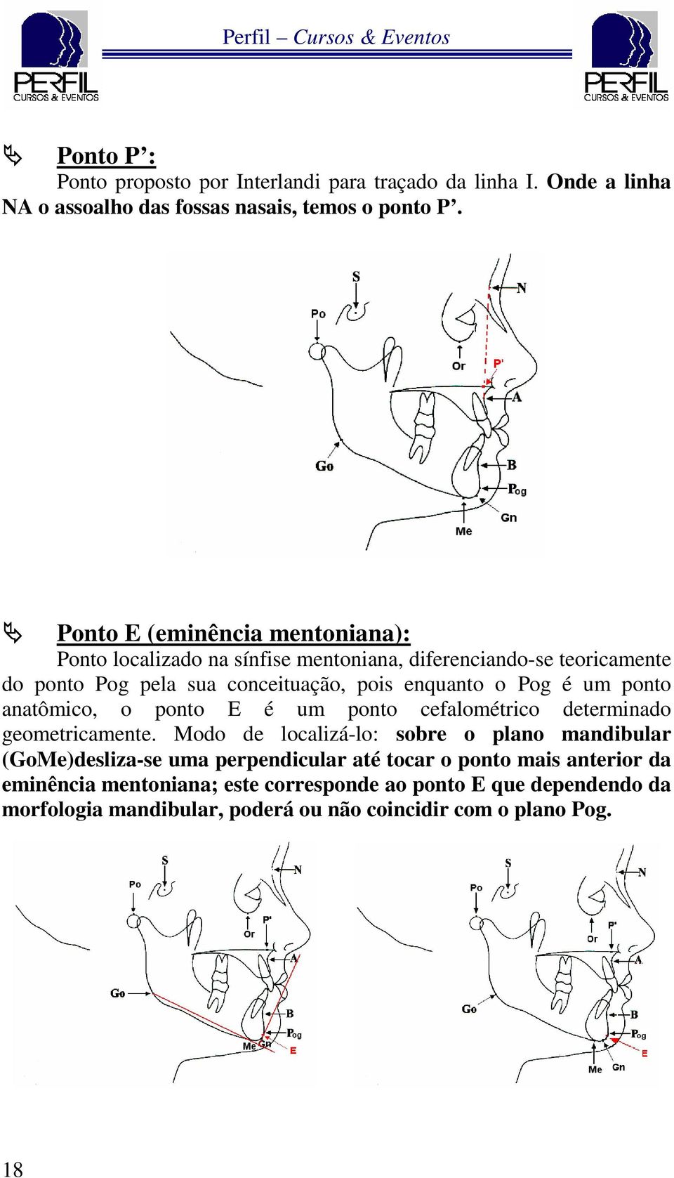 Pog é um ponto anatômico, o ponto E é um ponto cefalométrico determinado geometricamente.