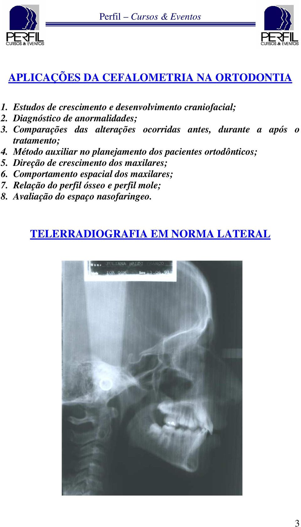 Método auxiliar no planejamento dos pacientes ortodônticos; 5. Direção de crescimento dos maxilares; 6.