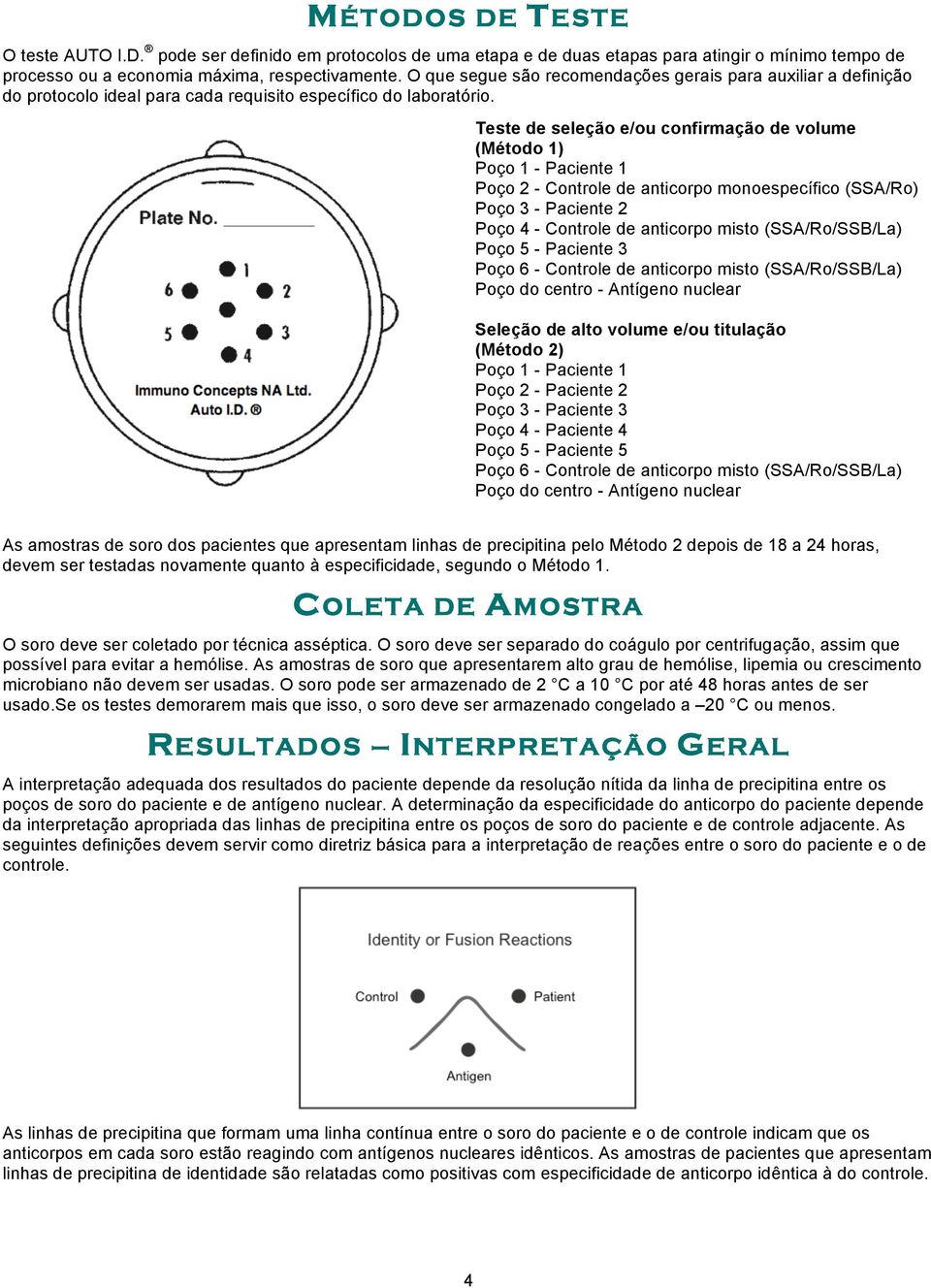 Teste de seleção e/ou confirmação de volume (Método 1) Poço 1 - Paciente 1 Poço 2 - Controle de anticorpo monoespecífico (SSA/Ro) Poço 3 - Paciente 2 Poço 4 - Controle de anticorpo misto