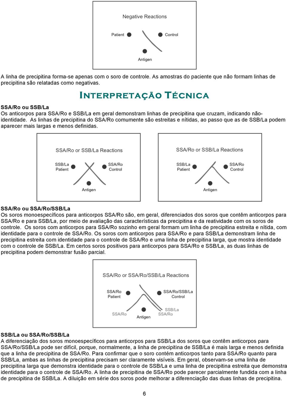 As linhas de precipitina do SSA/Ro comumente são estreitas e nítidas, ao passo que as de SSB/La podem aparecer mais largas e menos definidas.