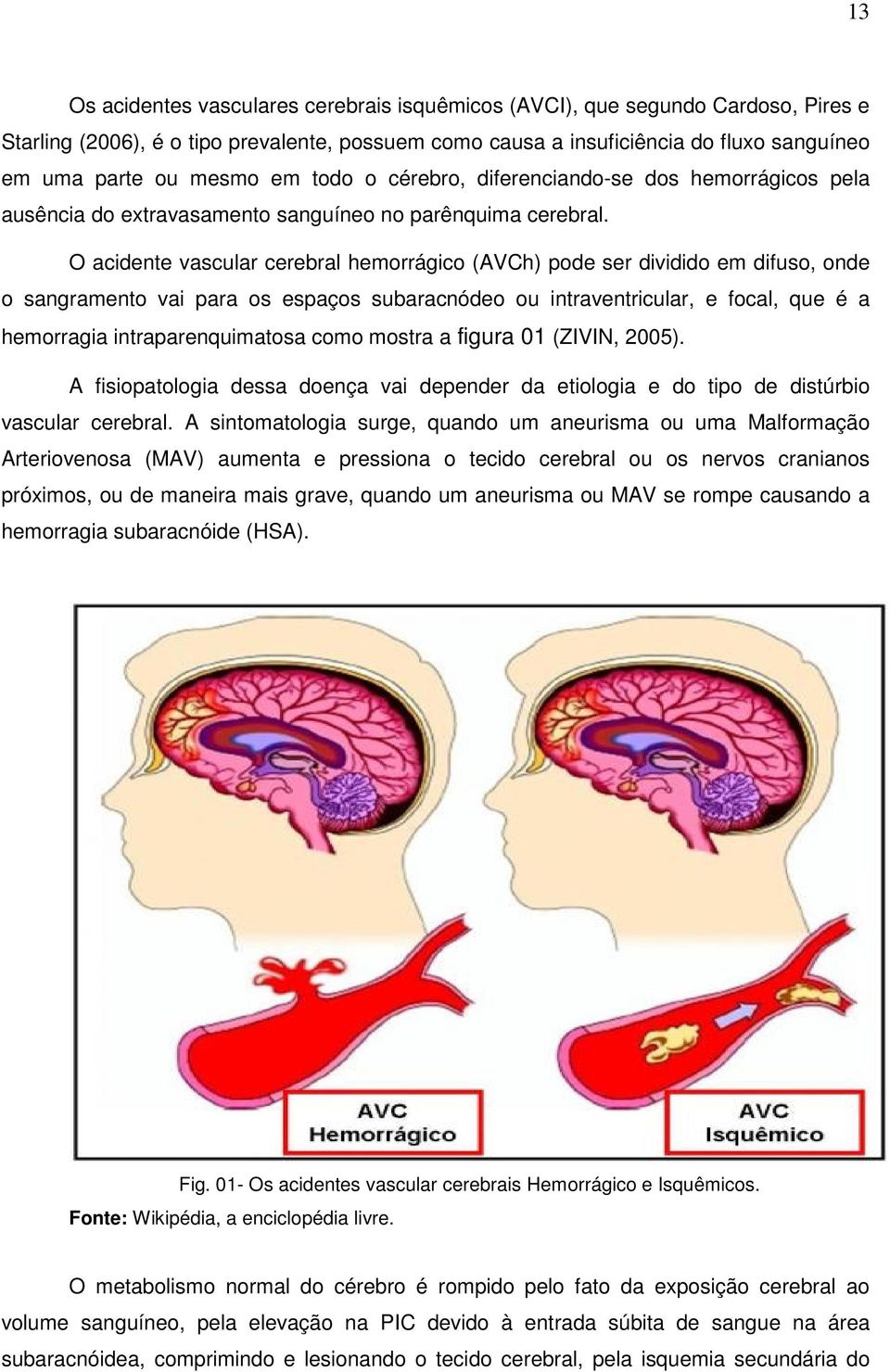 O acidente vascular cerebral hemorrágico (AVCh) pode ser dividido em difuso, onde o sangramento vai para os espaços subaracnódeo ou intraventricular, e focal, que é a hemorragia intraparenquimatosa