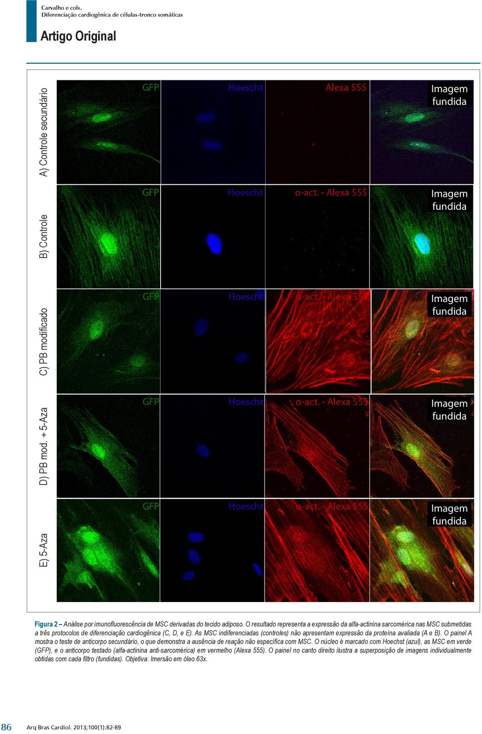 O resultado representa a expressão da alfa-actinina sarcomérica nas MSC submetidas a três protocolos de diferenciação cardiogênica (C, D, e E).