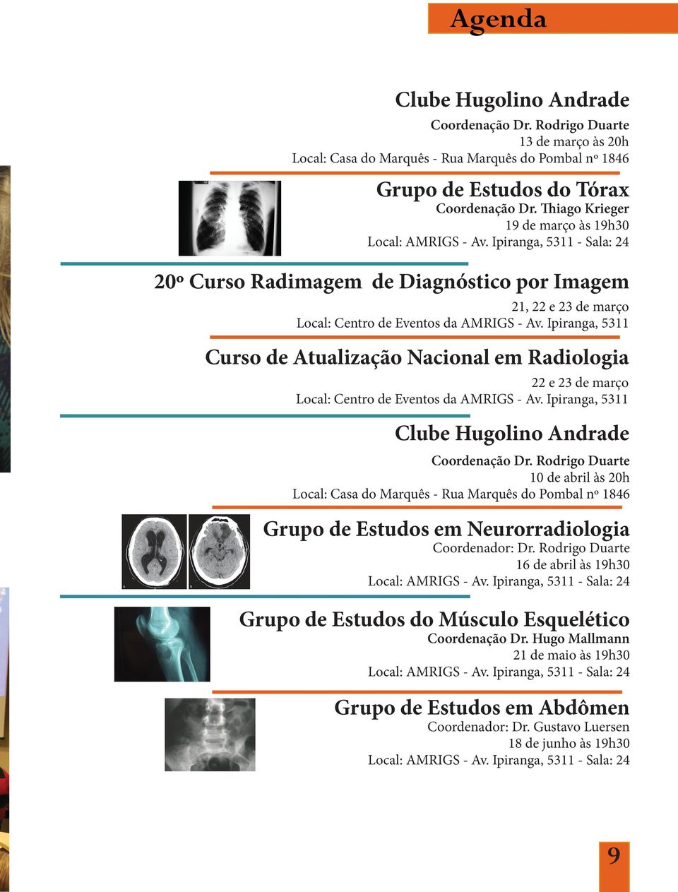 Ipiranga, 5311 Curso de Atualização Nacional em Radiologia 22 e 23 de março Local: Centro de Eventos da AMRIGS - Av. Ipiranga, 5311 Clube Hugolino Andrade Coordenação Dr.