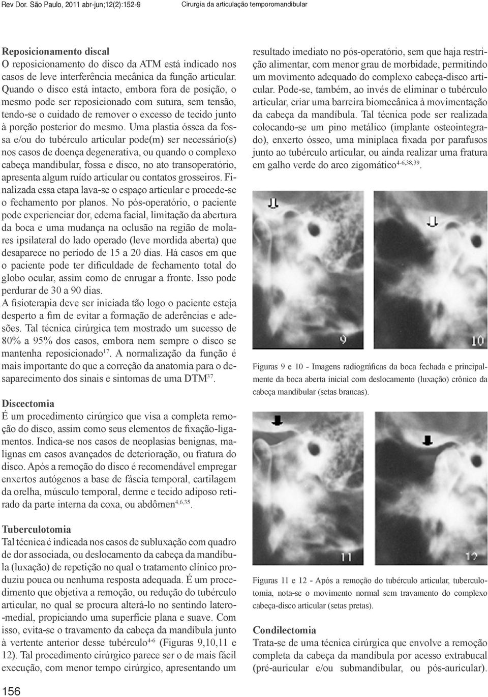 função articular.