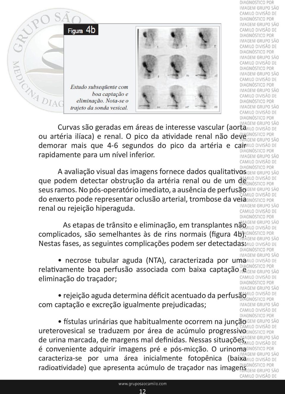 A avaliação visual das imagens fornece dados qualitativos que podem detectar obstrução da artéria renal ou de um de seus ramos.