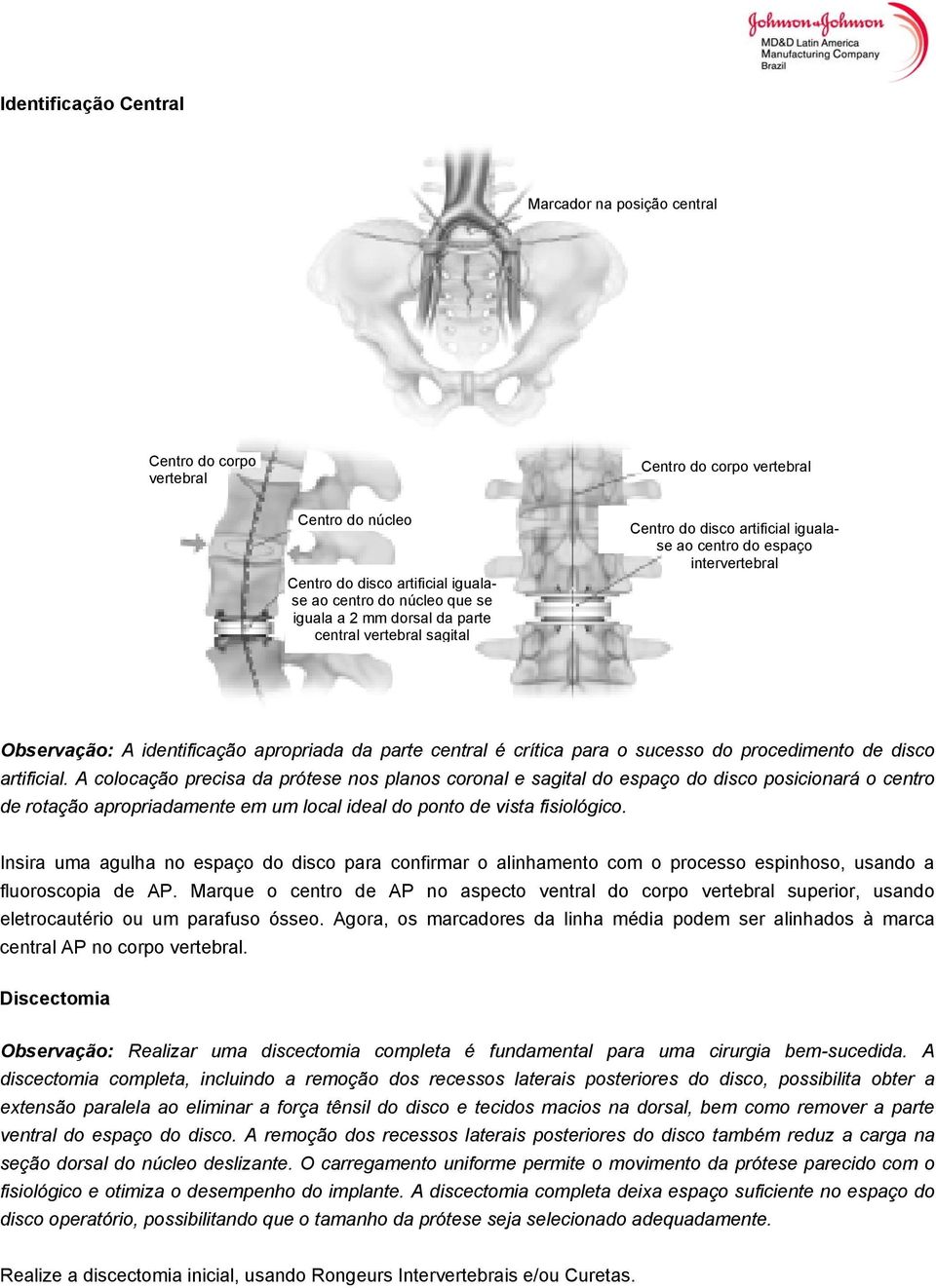 procedimento de disco artificial.