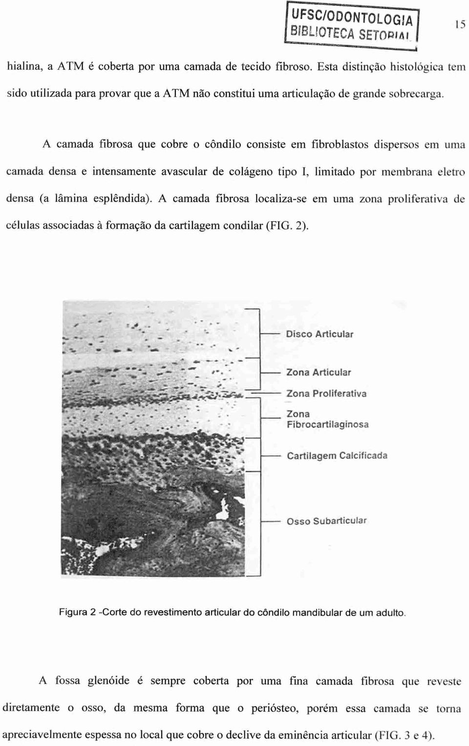 A camada fibrosa que cobre o côndilo consiste em fibroblastos dispersos em uma camada densa e intensamente avascular de coldgeno tipo I, limitado por membrana eletro densa (a lamina esplêndida).