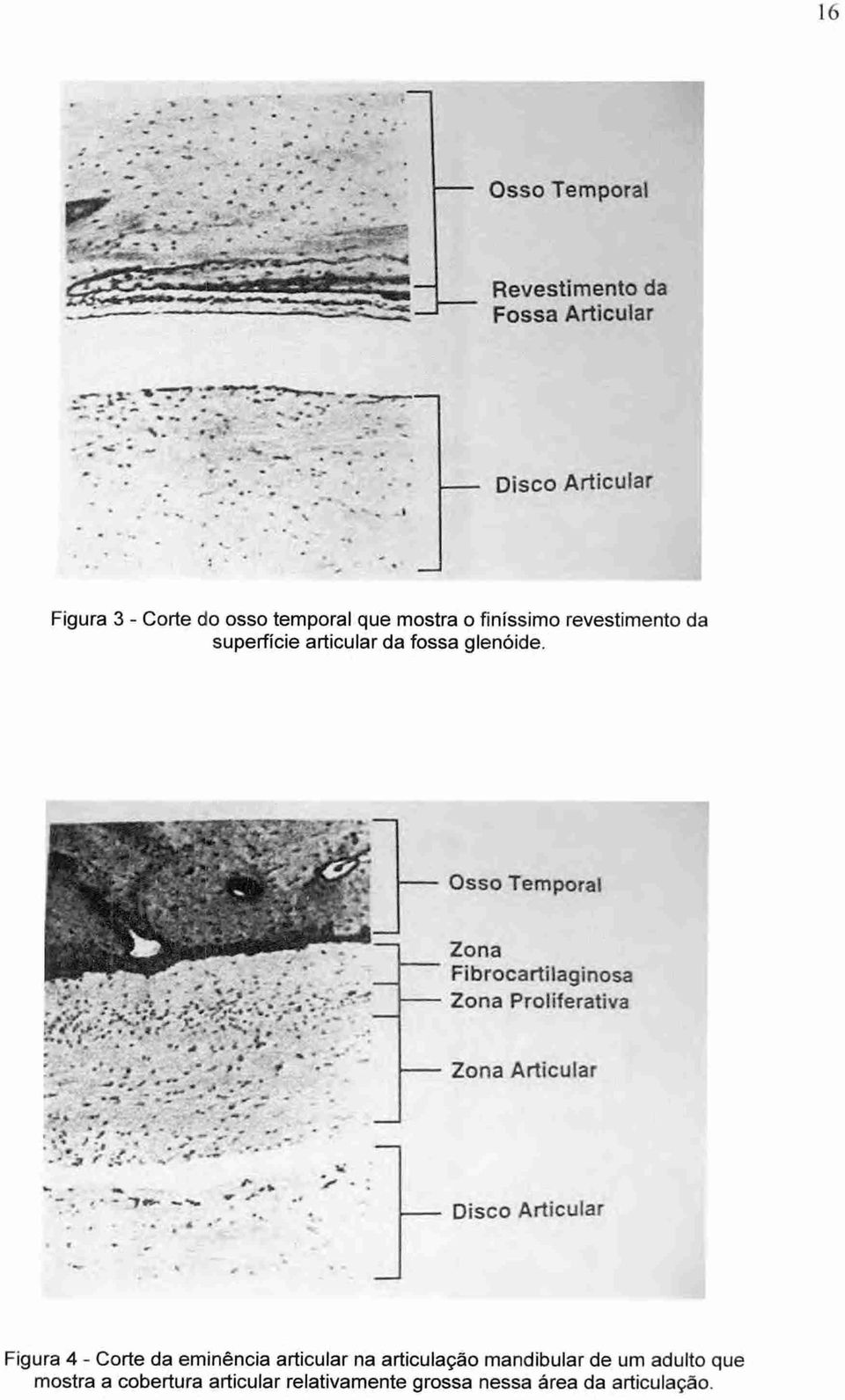 " I S`, d.. Zona Fibrocartilaginosa Zona Proliferativa Zona Articular ; Jr.