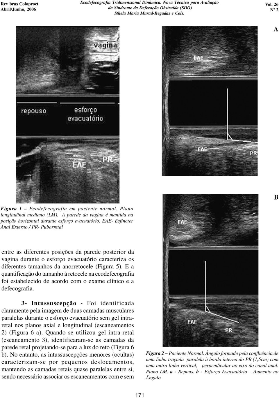 E a quantificação do tamanho à retocele na ecodefecografia foi estabelecido de acordo com o exame clínico e a defecografia.