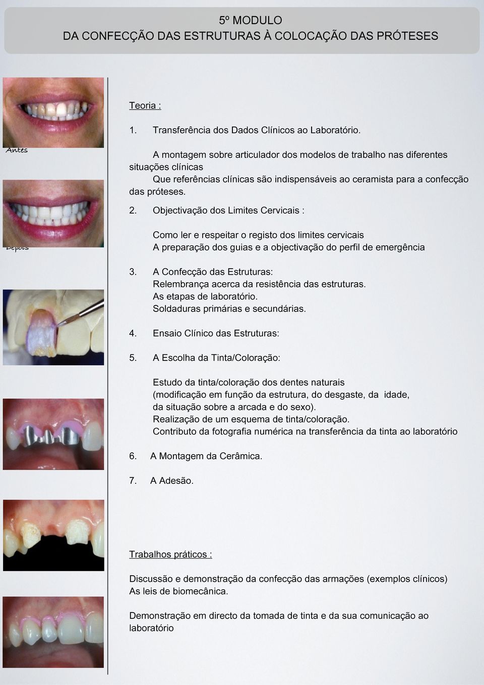 Objectivação dos Limites Cervicais : Como ler e respeitar o registo dos limites cervicais A preparação dos guias e a objectivação do perfil de emergência 3.