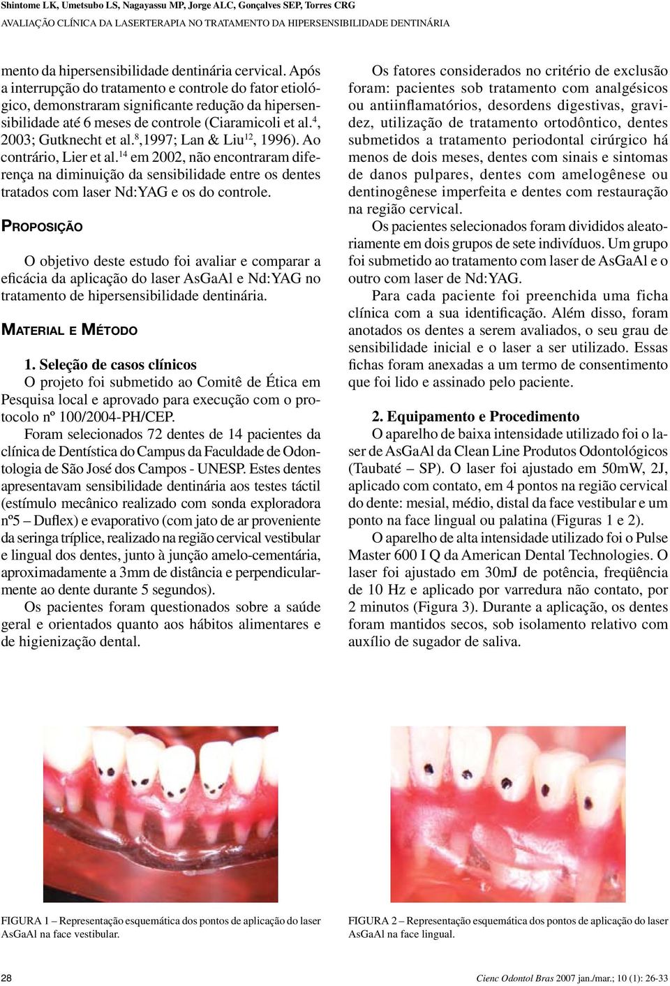 8,997; Lan & Liu, 996). Ao contrário, Lier et al. em 00, não encontraram diferença na diminuição da sensibilidade entre os dentes tratados com laser Nd:YAG e os do controle.