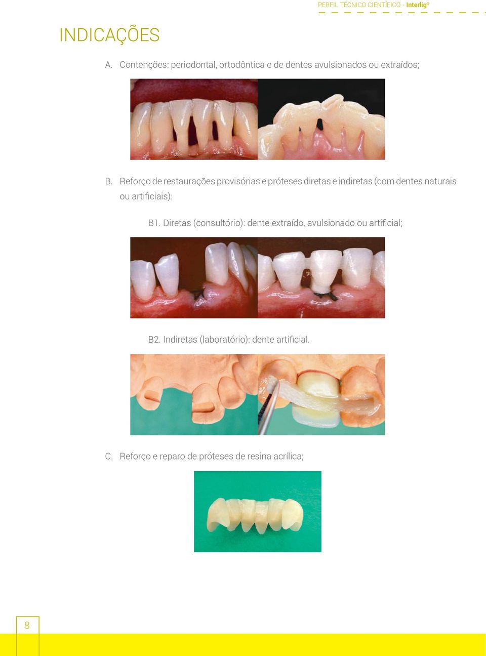artificiais): B1. Diretas (consultório): dente extraído, avulsionado ou artificial; B2.