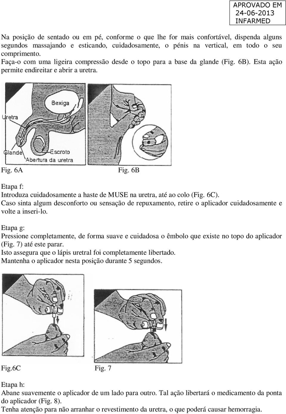 6B Etapa f: Introduza cuidadosamente a haste de MUSE na uretra, até ao colo (Fig. 6C). Caso sinta algum desconforto ou sensação de repuxamento, retire o aplicador cuidadosamente e volte a inseri-lo.