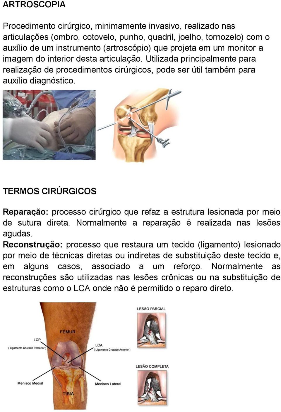 TERMOS CIRÚRGICOS Reparação: processo cirúrgico que refaz a estrutura lesionada por meio de sutura direta. Normalmente a reparação é realizada nas lesões agudas.