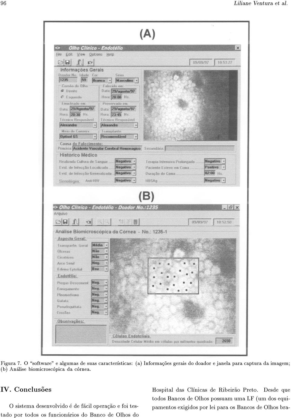 (b) Analise biomicroscopica da cornea. IV.