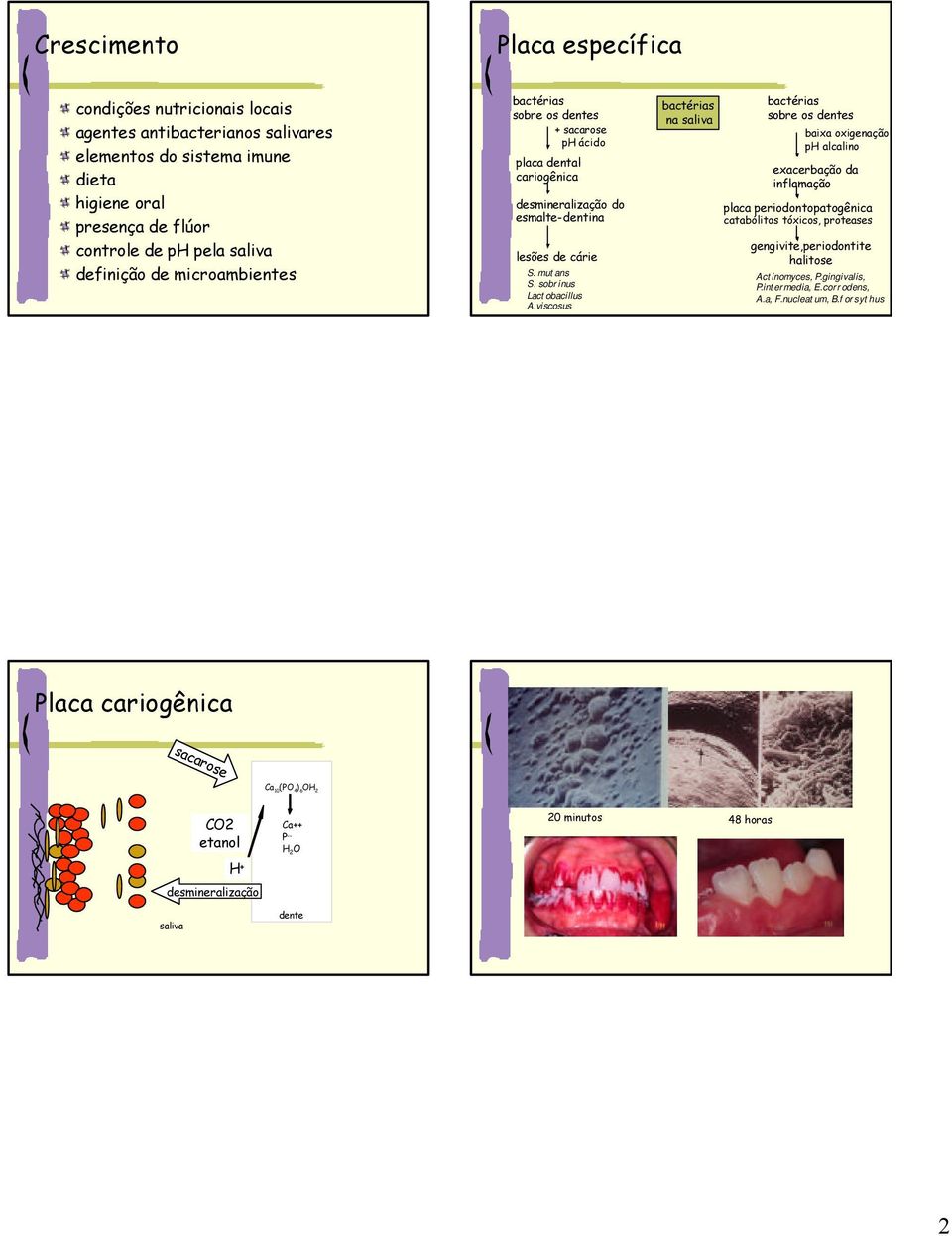 viscosus na saliva sobre os dentes baixa oxigenação ph alcalino exacerbação da inflamação placa periodontopatogênica catabólitos tóxicos, proteases gengivite,periodontite halitose