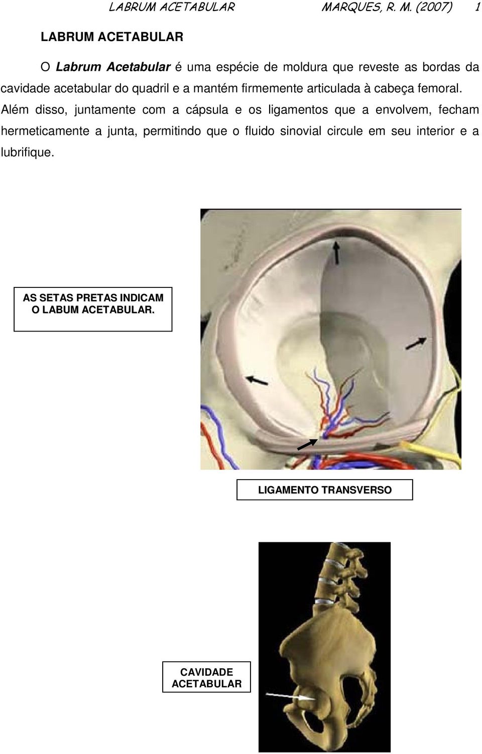 (2007) 1 LABRUM ACETABULAR O Labrum Acetabular é uma espécie de moldura que reveste as bordas da cavidade acetabular