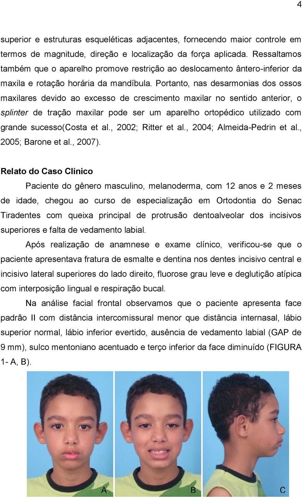 Portanto, nas desarmonias dos ossos maxilares devido ao excesso de crescimento maxilar no sentido anterior, o splinter de tração maxilar pode ser um aparelho ortopédico utilizado com grande