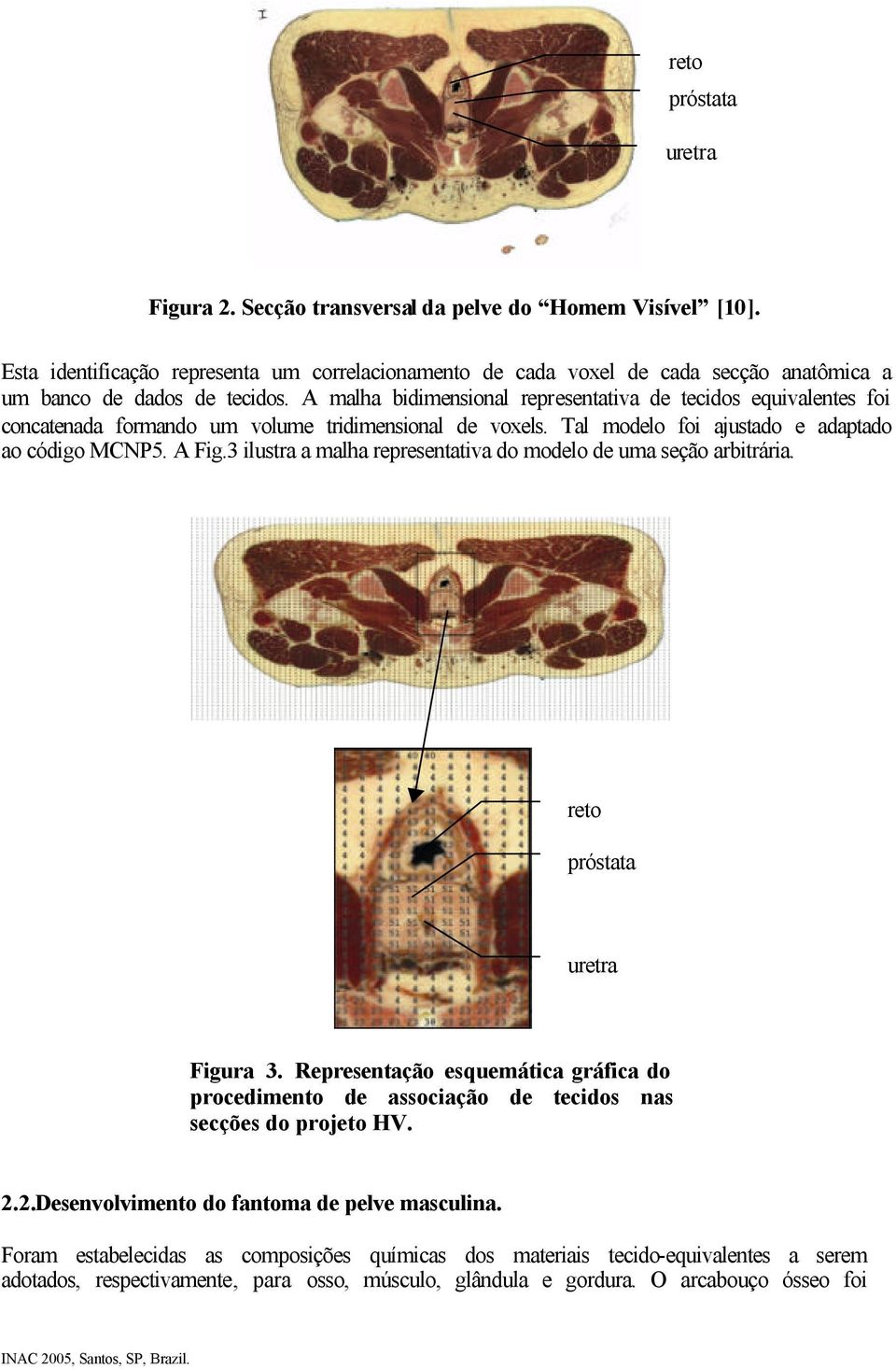 A malha bidimensional representativa de tecidos equivalentes foi concatenada formando um volume tridimensional de voxels. Tal modelo foi ajustado e adaptado ao código MCNP5. A Fig.