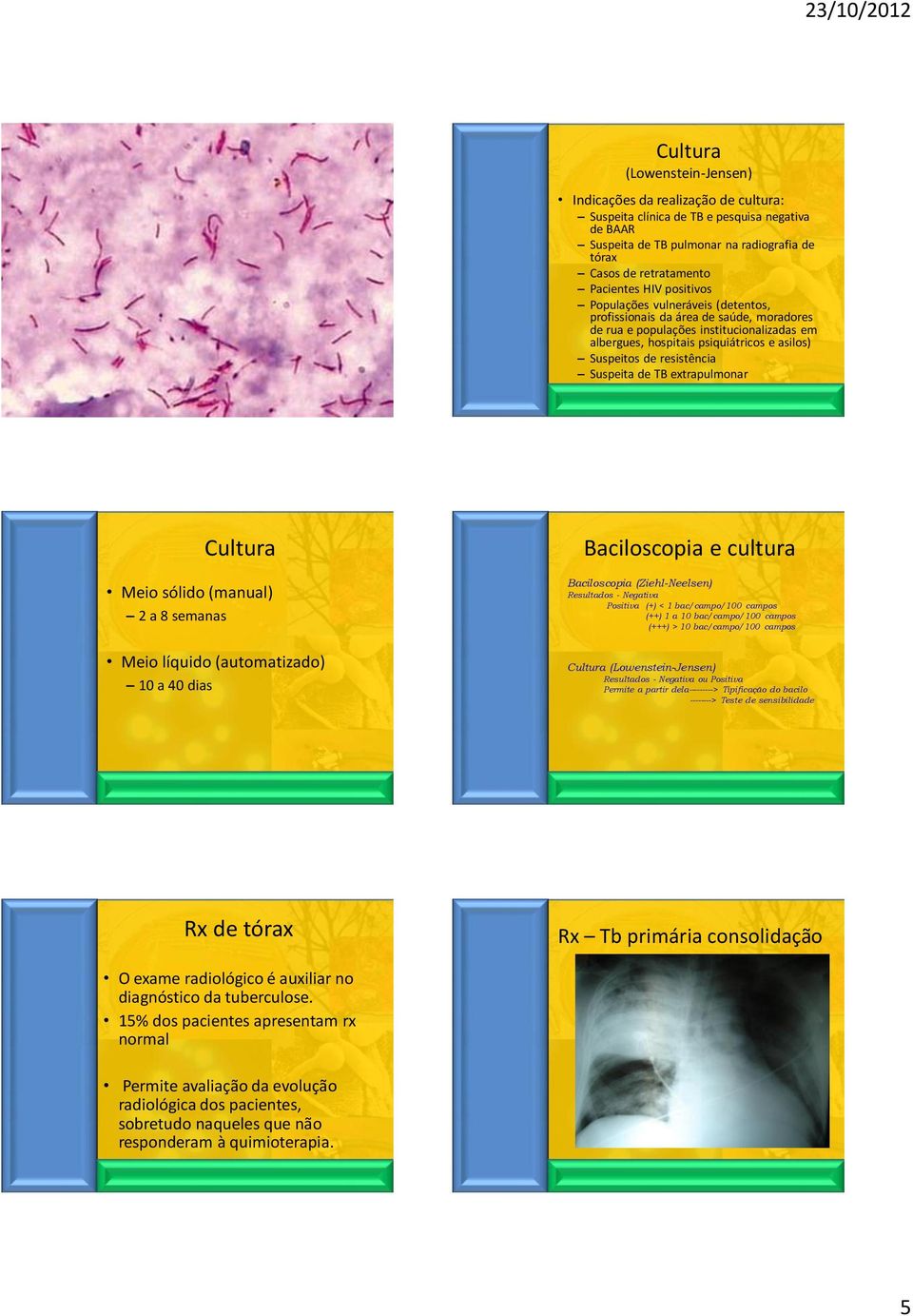 Suspeita de TB extrapulmonar Cultura Meio sólido (manual) 2 a 8 semanas Meio líquido (automatizado) 10 a 40 dias Baciloscopia e cultura Baciloscopia (Ziehl-Neelsen) Resultados - Negativa Positiva (+)