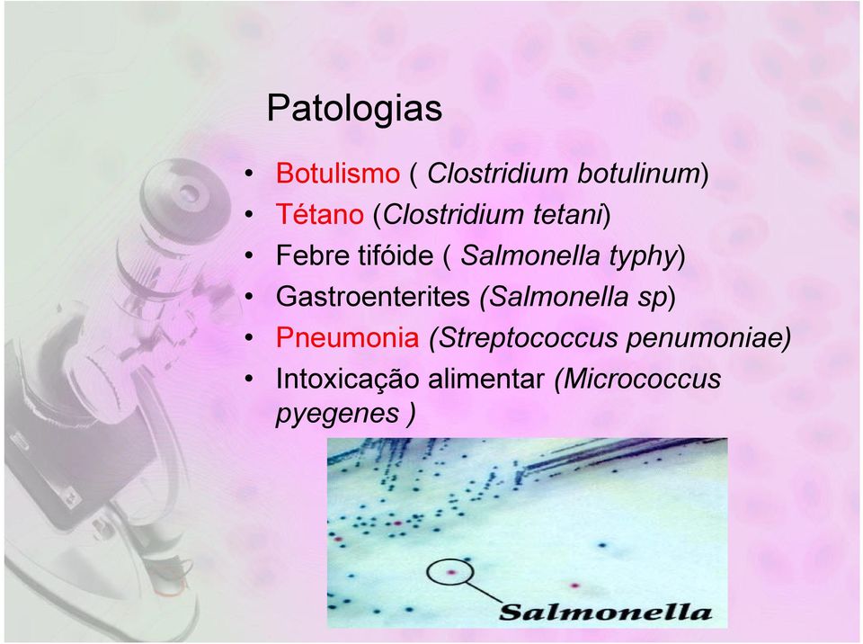 Gastroenterites (Salmonella sp) Pneumonia