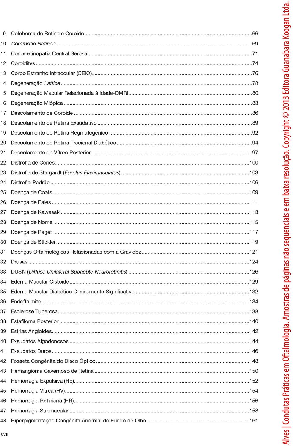 ..92 20 Descolamento de Retina Tracional Diabético...94 21 Descolamento do Vítreo Posterior...97 22 Distrofia de Cones...100 23 Distrofia de Stargardt (Fundus Flavimaculatus)...103 24 Distrofia-Padrão.