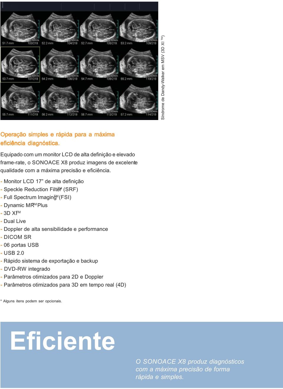 - Monitor LCD 17 de alta definição TM - Speckle Reduction Filter (SRF) - Full Spectrum Imaging TM (FSI) - Dynamic MR TM Plus - 3D XI TM - Dual Live - Doppler de alta sensibilidade e performance