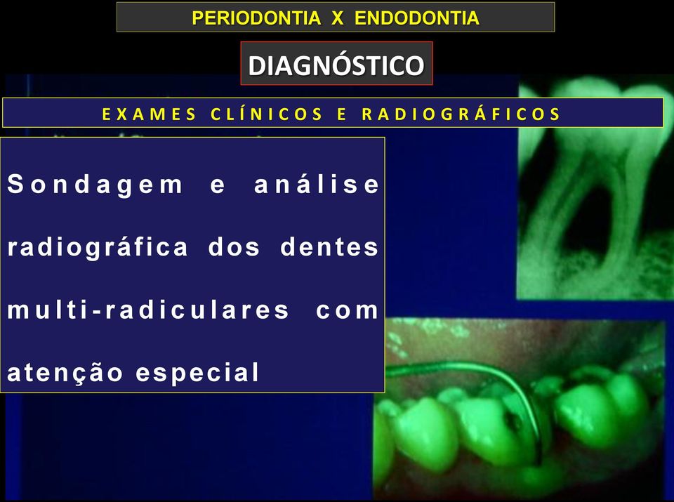 Sondagem e análise radiográfica dos