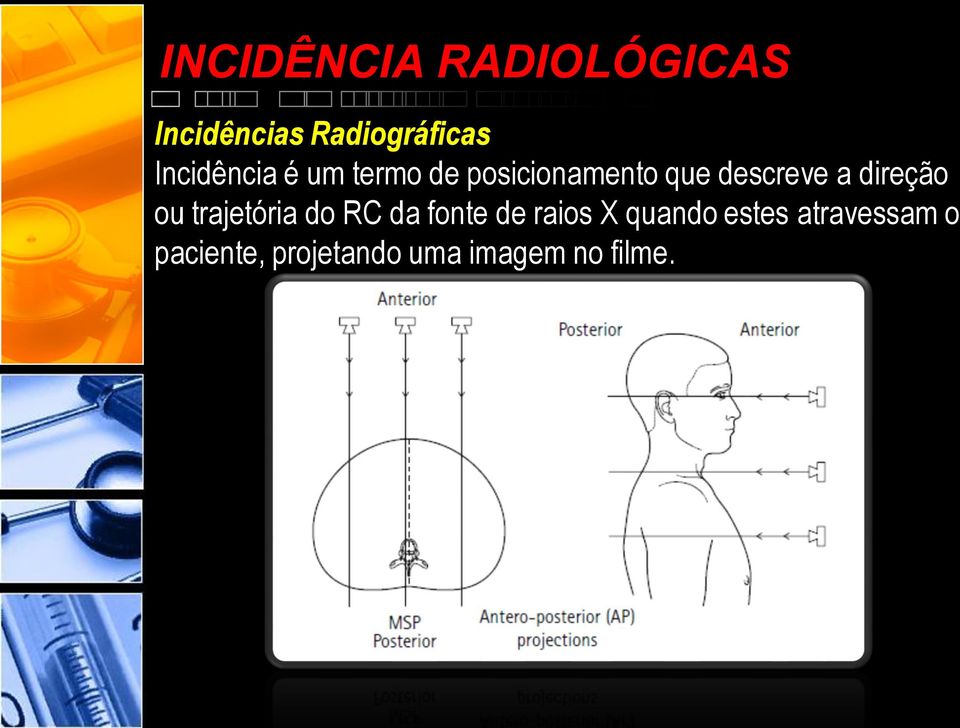 direção ou trajetória do RC da fonte de raios X quando